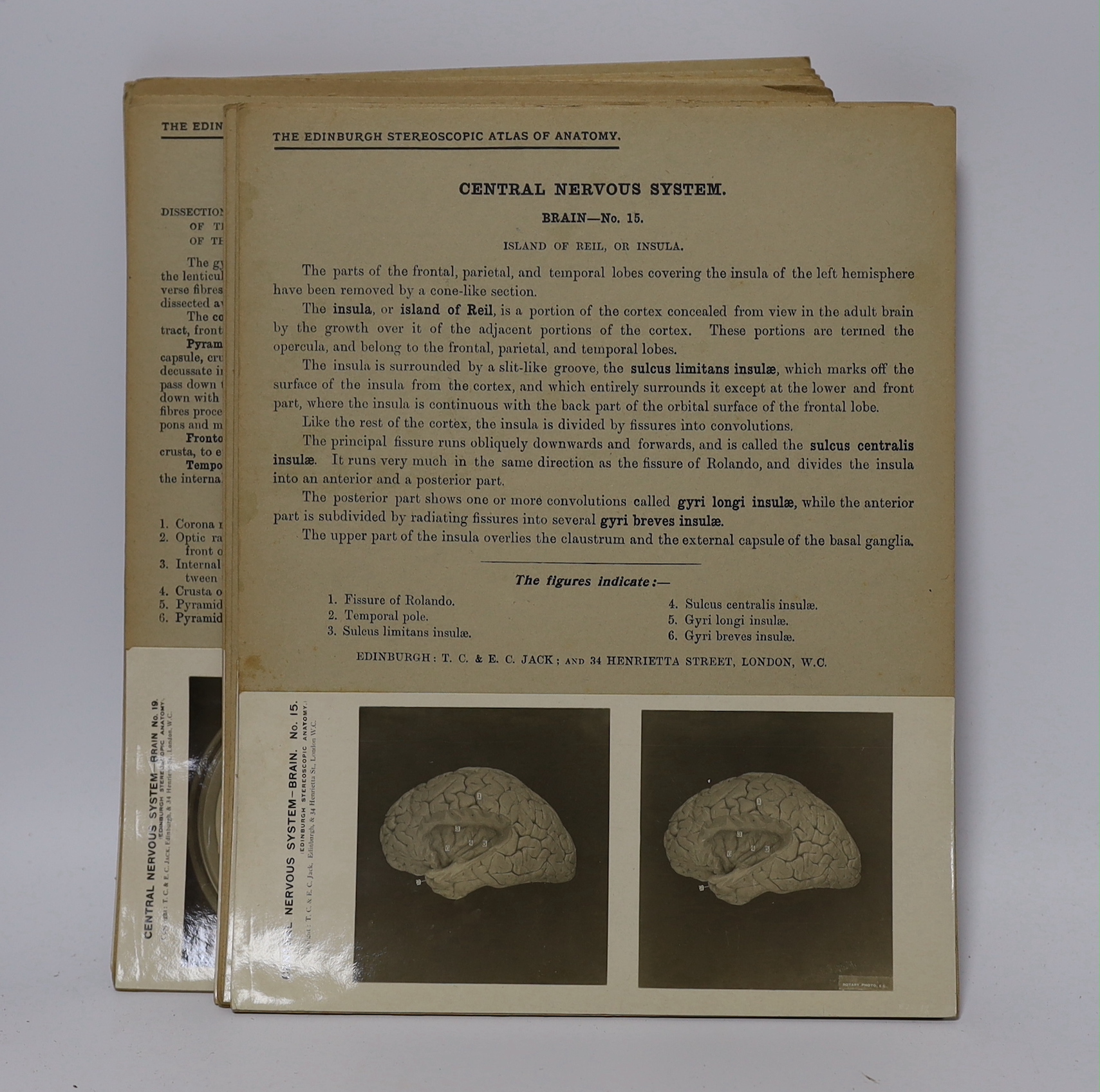 Stereoscopic cards from a set by The Edinburgh Stereoscopic Atlas of Anatomy with detailed information above the photographs, together with a small number of additional cards of different subjects